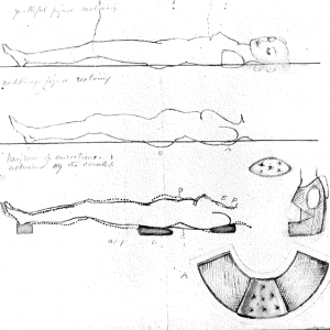 Loy's drawings of corselet